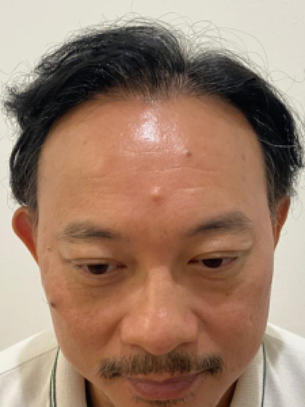 After